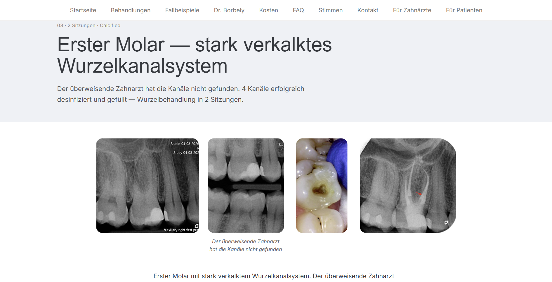 wurzelbehandlungen.ch weboldal fejlesztés esettanulmányok